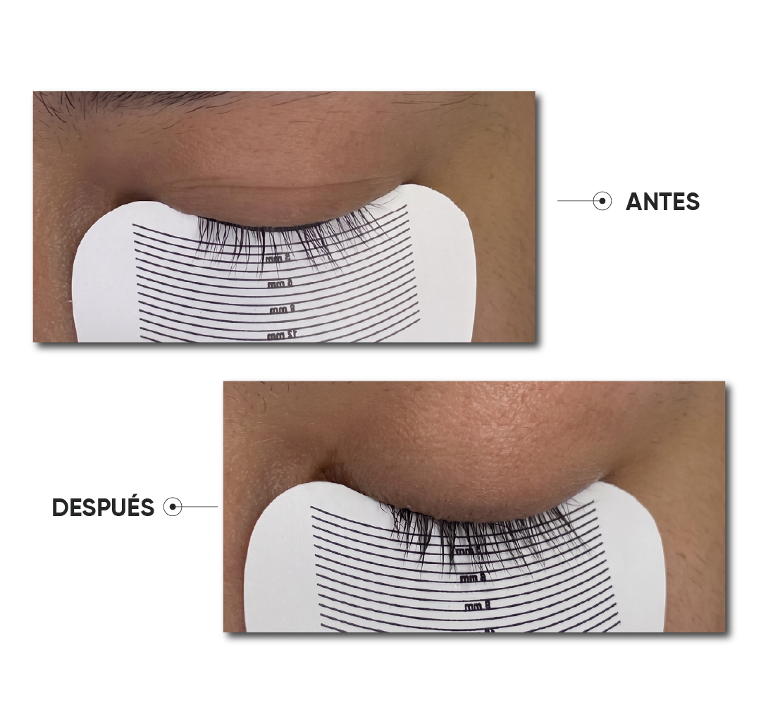 Antes y después · Caso 9