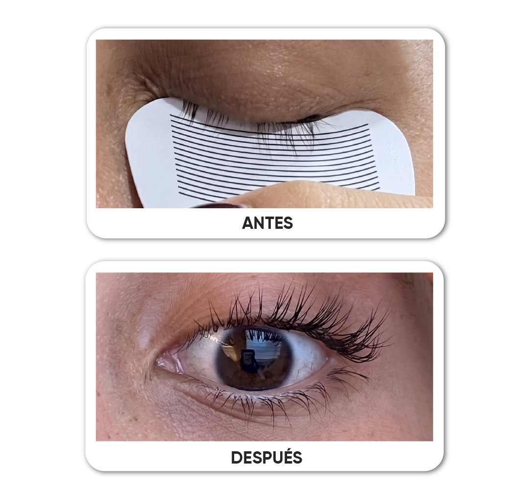 Antes y después · Caso 10
