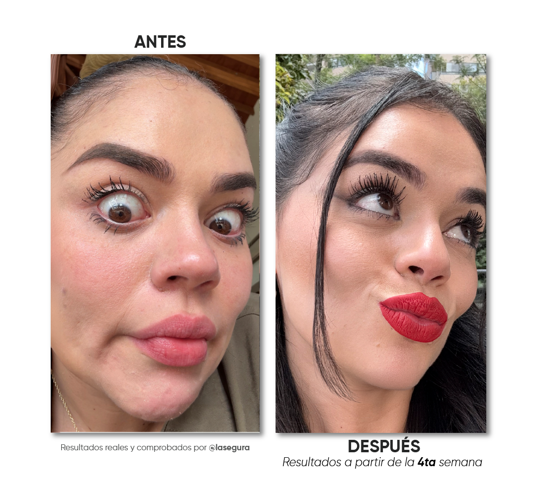 Antes y después · Caso 1