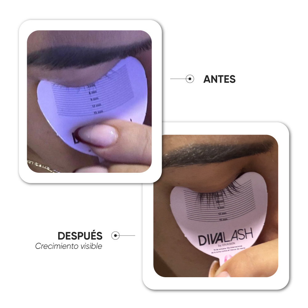 Antes y después · Caso 6